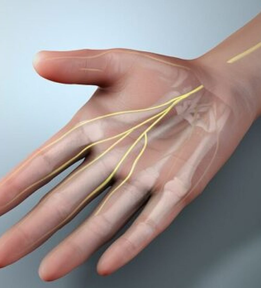 Sinir-Yaralanmalari-463x348